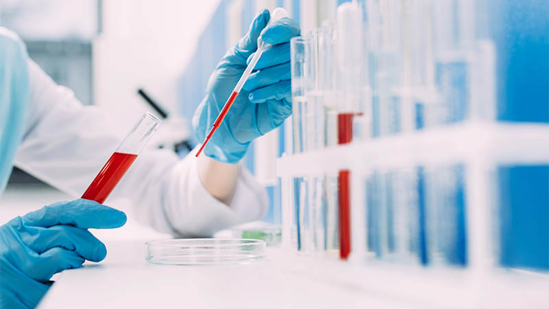 Image - فحوصات إلزامية بعد سن الأربعين